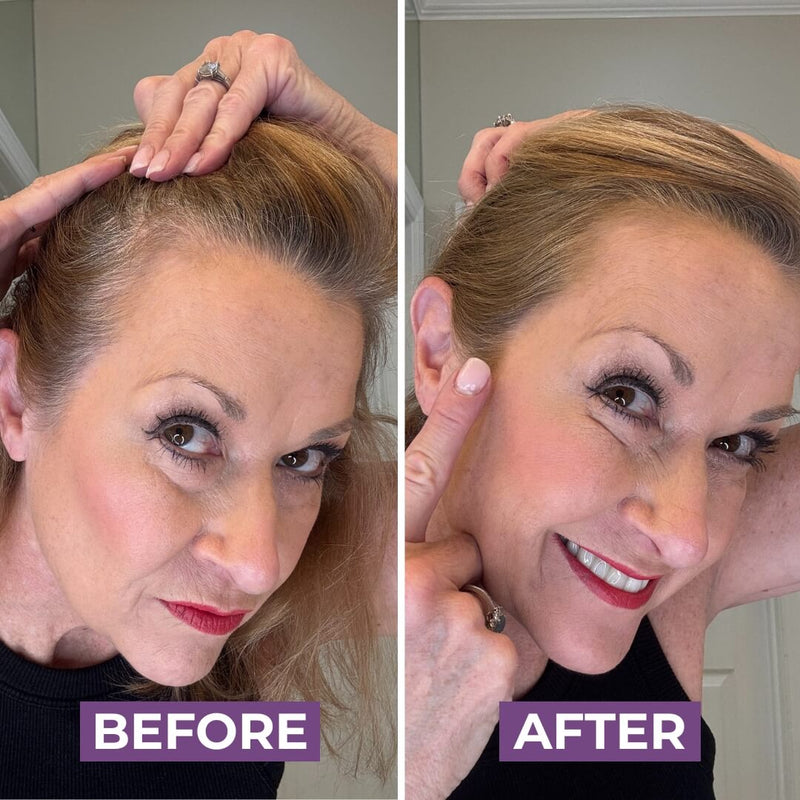 Olivia K.’s hair before HairMagic+ Hairline Powder
