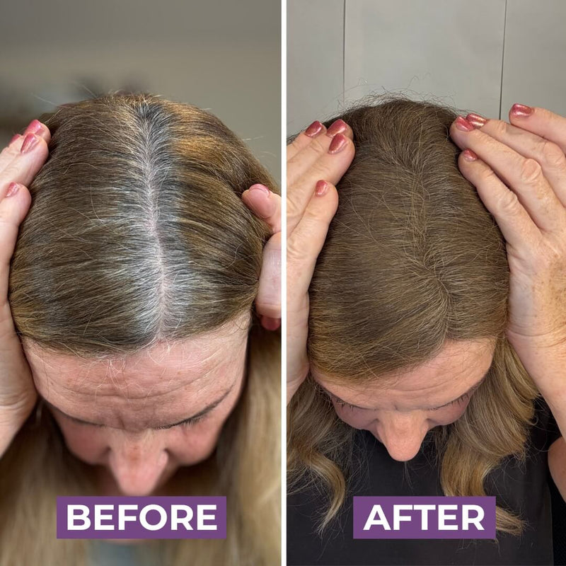 Jessica B.’s hair before HairMagic+ Hairline Powder