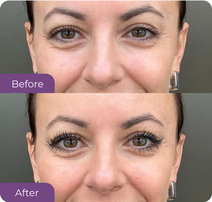 Ann Downward’s eye before LushLine+ Waterproof Eyeliner