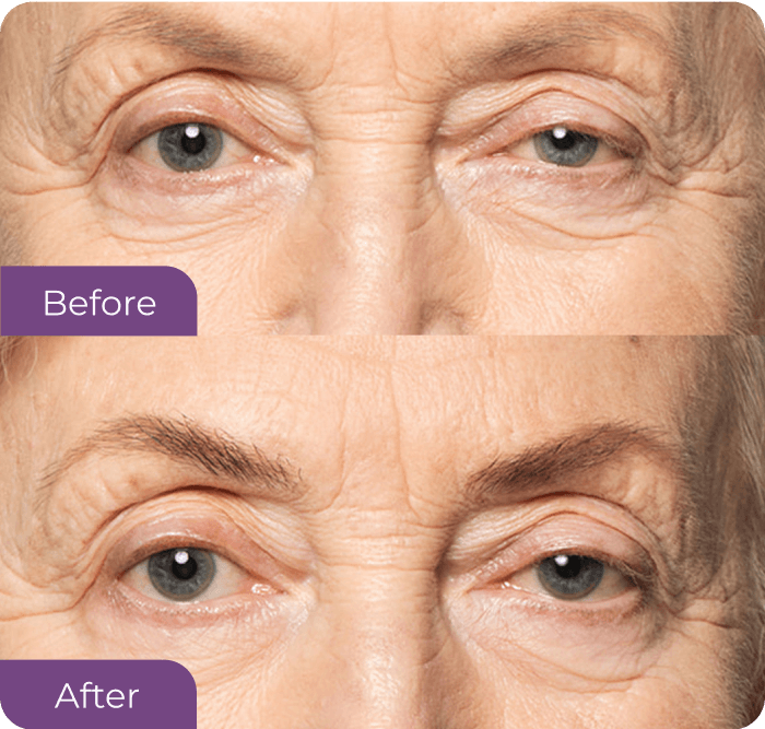 Jane Alexander's eyebrow before PowerBrow+
