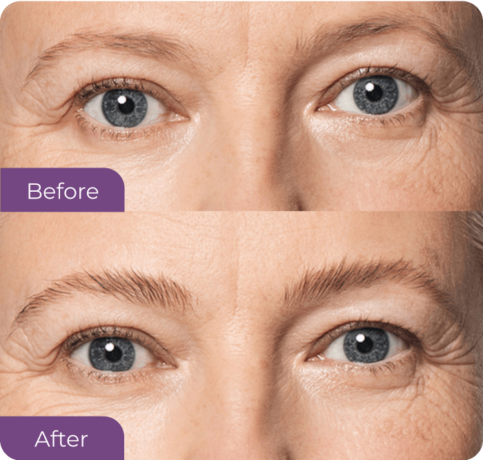Naomi Preece's eyebrow before PowerBrow+