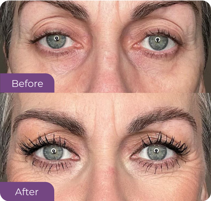 Sally West’s eye before LushLine+ Waterproof Eyeliner
